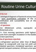 Image result for Urine Culture Routine