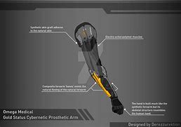 Image result for Cybernetic Prosthetic Arm