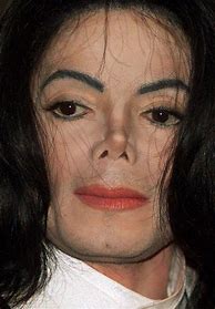 Image result for Michael Jackson Facial Surgery