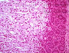Image result for axrenal