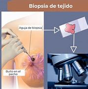 Image result for biopeia