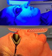 Image result for Laser Light Therapy