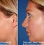 Image result for Boxy Nose Tip