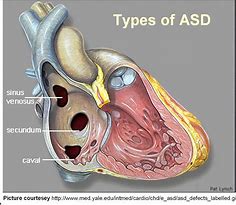 Image result for Asd Location