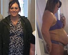 Image result for Obese Female Weight Loss