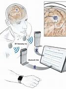 Image result for Top 10 Brain Devices