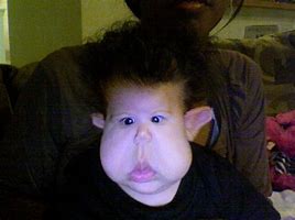 Image result for Cyclopia Baby