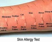 Image result for Environmental Allergies List
