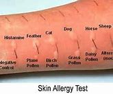 Image result for Environmental Allergies Examples