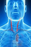 Image result for Carotid Artery Inflammation Neck Pain