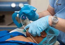 Image result for Pediatric Anesthesia