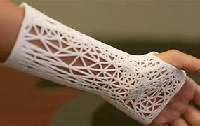 Image result for 3D Printed Device