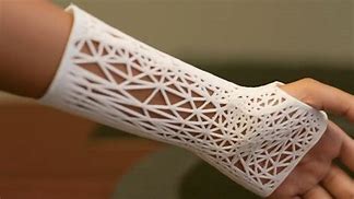 Image result for 3D Printed Medical Equipment