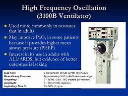Image result for New Modes of Ventilation