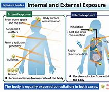Image result for Nuclear Radiation Exposure