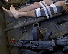 Image result for IED Wound Iraq