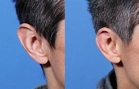 Image result for Big Ears vs Small Ears