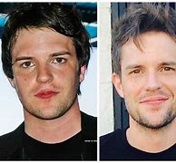 Image result for Brandon Flowers Before and After
