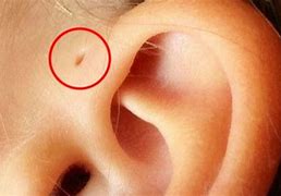 Image result for abofe6ear