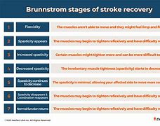Image result for Stroke Recovery After 10 Years
