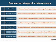 Image result for Full Recovery Stroke
