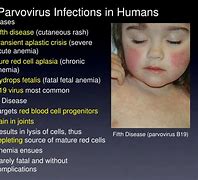 Image result for Parvovirus