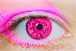 Image result for Rare Pink Eye Color