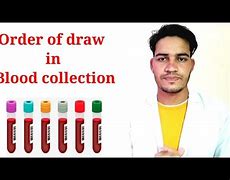 Image result for Order of Draw Cheat Sheet