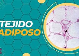 Image result for adiposos