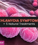 Image result for Chlamydia On the Skin in Women