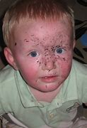 Image result for Cow Ant Sting