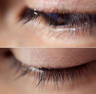 Image result for Lash Lice