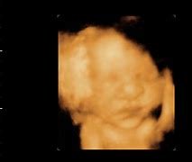 Image result for Philips 3D Ultrasound