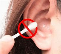 Image result for Dissolve Ear Wax