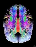 Image result for Artistic Brain