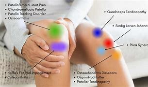 Image result for Knee Vins Sharp Pain
