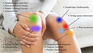 Image result for Sharp Pain On Right Knee