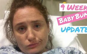 Image result for 9 Weeks Pregnant with Twins