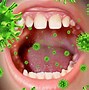 Image result for Rotten Teeth Mouth