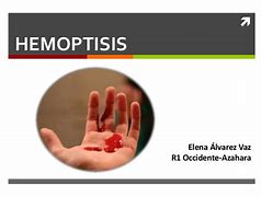 Image result for hemoptisis