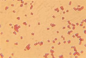 diplococcus 的图像结果