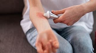 Image result for Application of Topical Medication