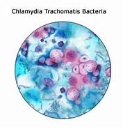 Image result for Chlamydia Gram