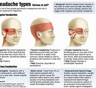 Image result for Eye Pain PNG