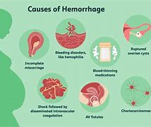 Image result for Hemorrhage