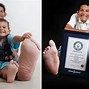 Image result for Biggest Feet in the World
