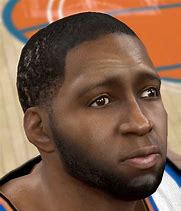 Image result for Tracy McGrady Lazy Eye