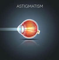 Image result for Red Eye Astigmatism