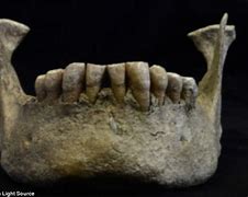 Image result for Old Human Skull Teeth