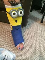 Image result for Minion Legs